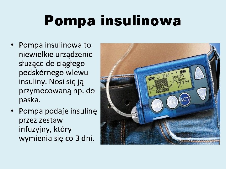 Pompa insulinowa • Pompa insulinowa to niewielkie urządzenie służące do ciągłego podskórnego wlewu insuliny.