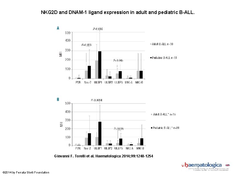 NKG 2 D and DNAM-1 ligand expression in adult and pediatric B-ALL. Giovanni F.