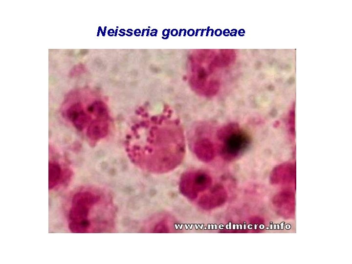 Neisseria gonorrhoeae 