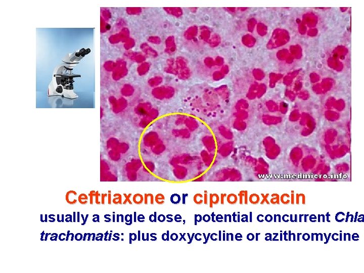 Ceftriaxone or ciprofloxacin usually a single dose, potential concurrent Chla trachomatis: plus doxycycline or