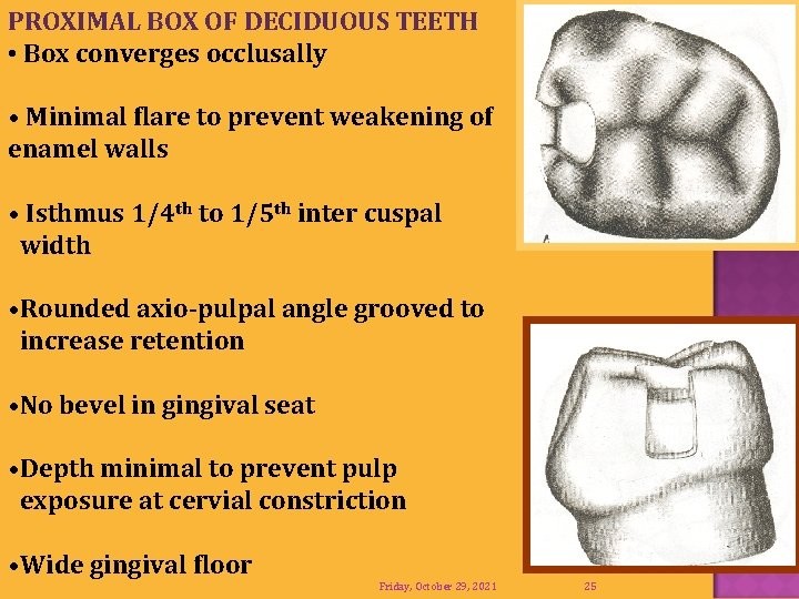 PROXIMAL BOX OF DECIDUOUS TEETH • Box converges occlusally • Minimal flare to prevent