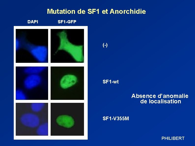 Mutation de SF 1 et Anorchidie DAPI SF 1 -GFP (-) SF 1 -wt
