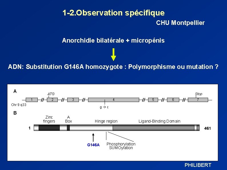 1 -2. Observation spécifique CHU Montpellier Anorchidie bilatérale + micropénis ADN: Substitution G 146