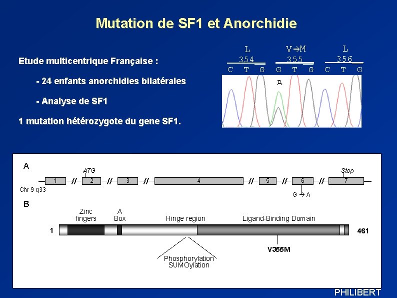 Mutation de SF 1 et Anorchidie V M L 356__ C T G 355__