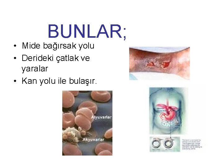 BUNLAR; • Mide bağırsak yolu • Derideki çatlak ve yaralar • Kan yolu ile