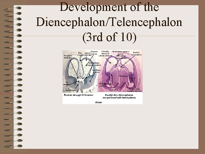 Development of the Diencephalon/Telencephalon (3 rd of 10) 
