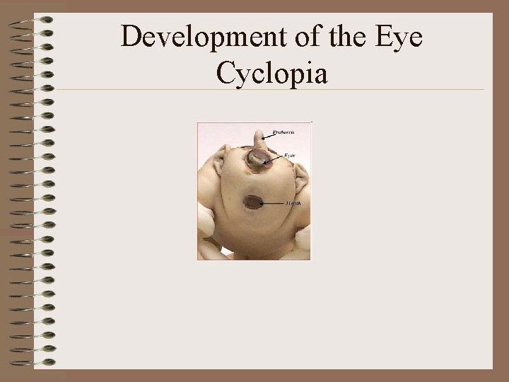 Development of the Eye Cyclopia 