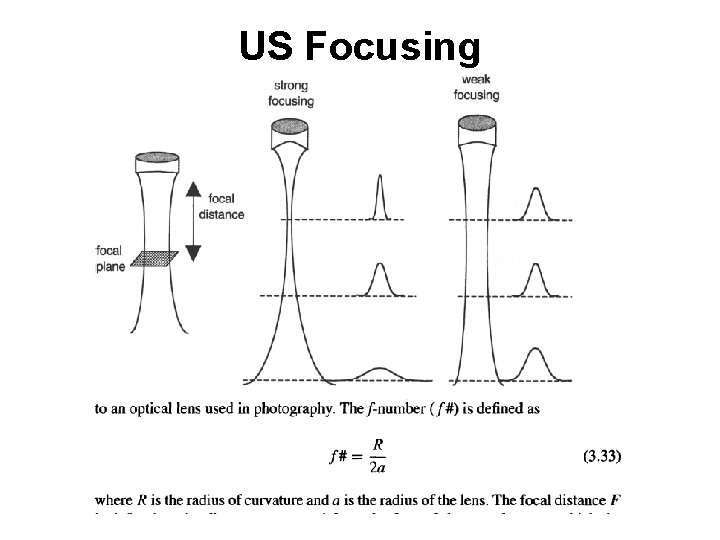 US Focusing US Focusing