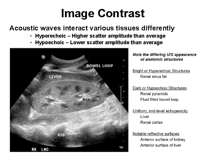 Image Contrast Acoustic waves interact various tissues differently • Hyperechoic – Higher scatter amplitude Image Contrast Acoustic waves interact various tissues differently • Hyperechoic – Higher scatter amplitude
