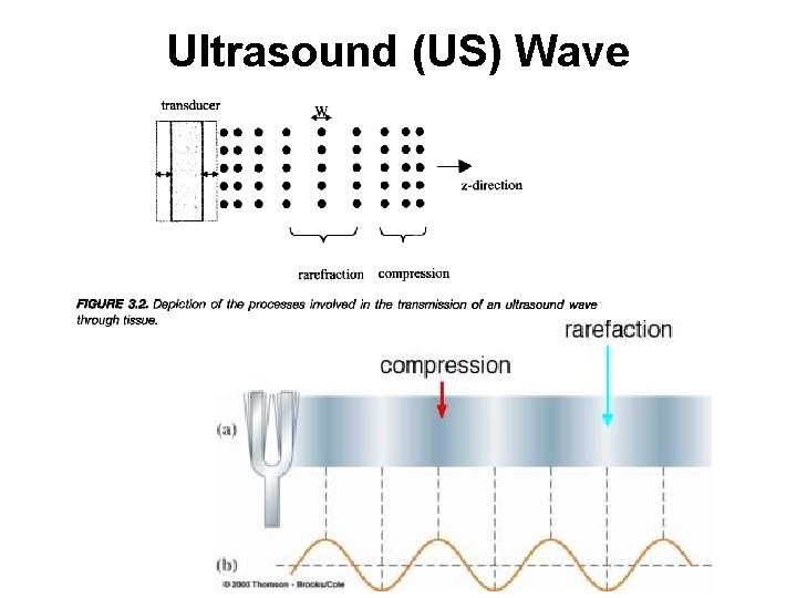 Ultrasound (US) Wave Ultrasound (US) Wave