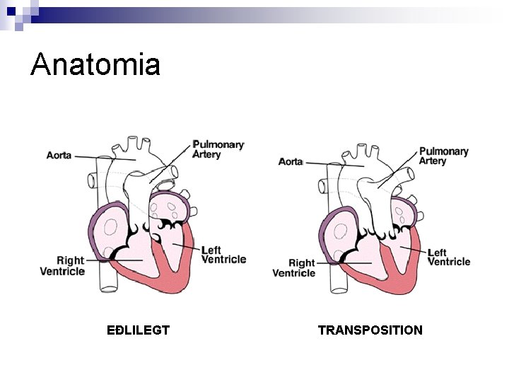 Anatomia EÐLILEGT TRANSPOSITION 