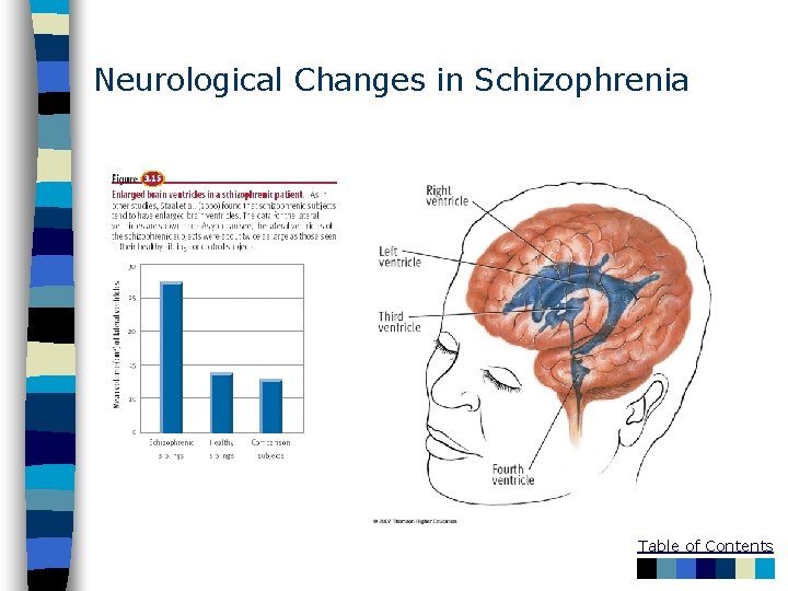 Neurological Changes in Schizophrenia Table of Contents 