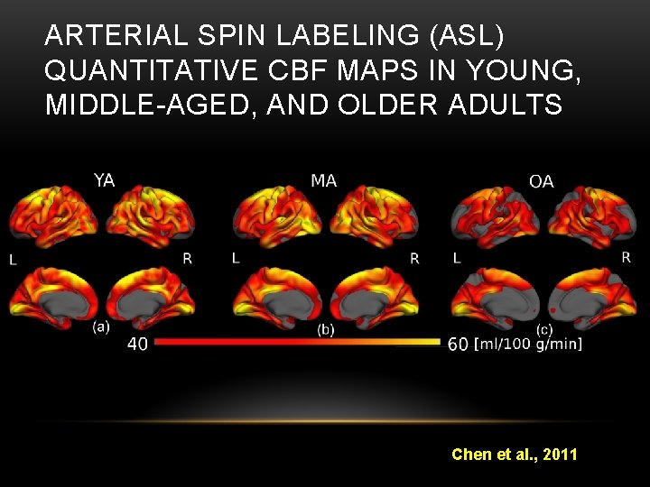 ARTERIAL SPIN LABELING (ASL) QUANTITATIVE CBF MAPS IN YOUNG, MIDDLE-AGED, AND OLDER ADULTS <40