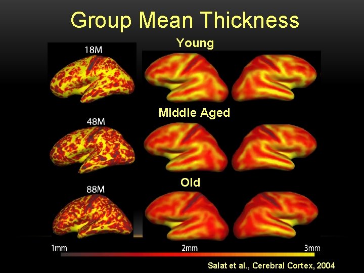 Group Mean Thickness Young Middle Aged Old Salat et al. , Cerebral Cortex, 2004