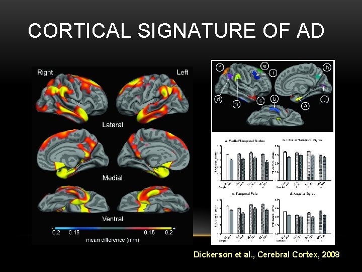 CORTICAL SIGNATURE OF AD Dickerson et al. , Cerebral Cortex, 2008 