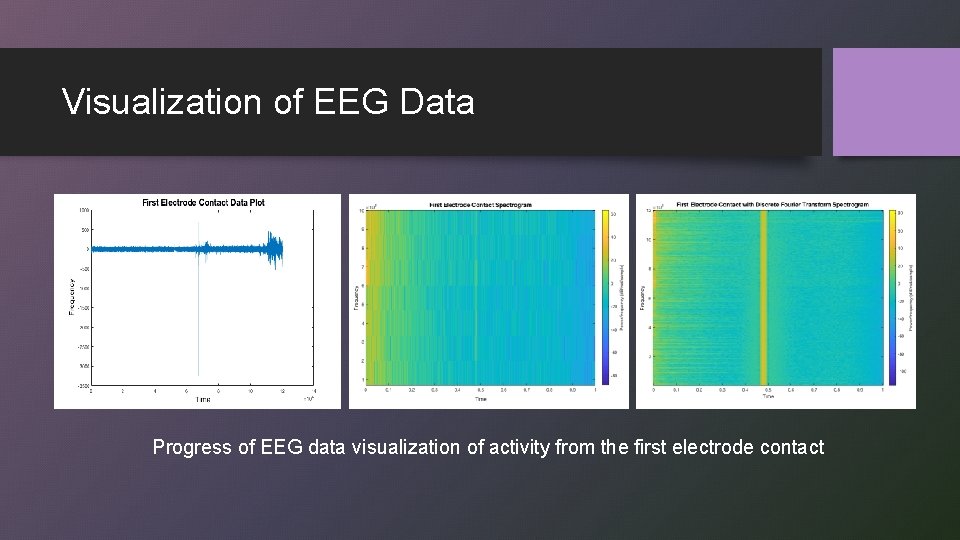 Visualization of EEG Data Progress of EEG data visualization of activity from the first