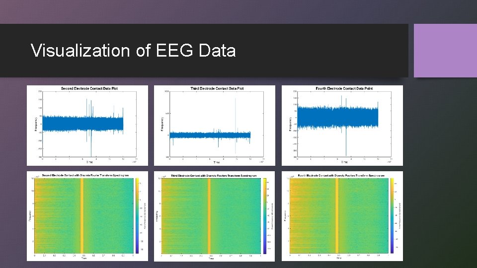 Visualization of EEG Data 