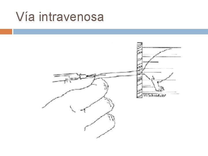 Vía intravenosa 