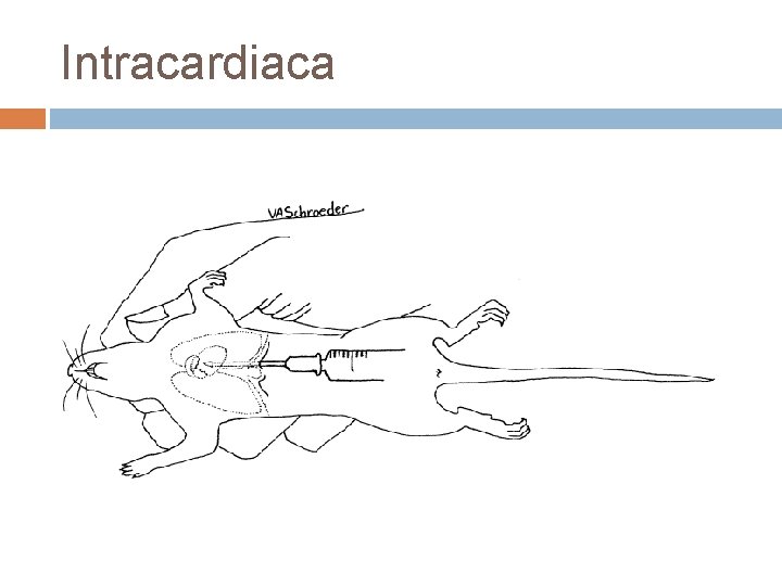Intracardiaca 