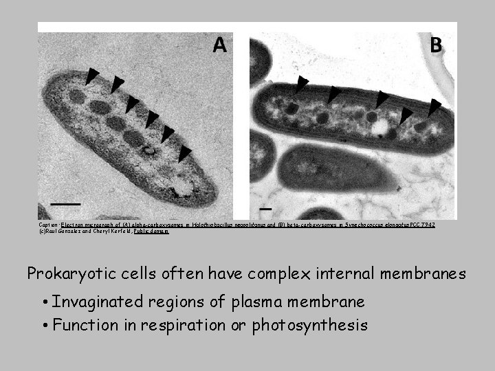 Caption: Electron micrograph of (A) alpha-carboxysomes in Halothiobacillus neapolitanus and (B) beta-carboxysomes in Synechococcus