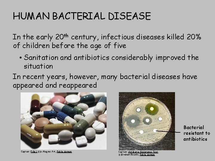 HUMAN BACTERIAL DISEASE In the early 20 th century, infectious diseases killed 20% of