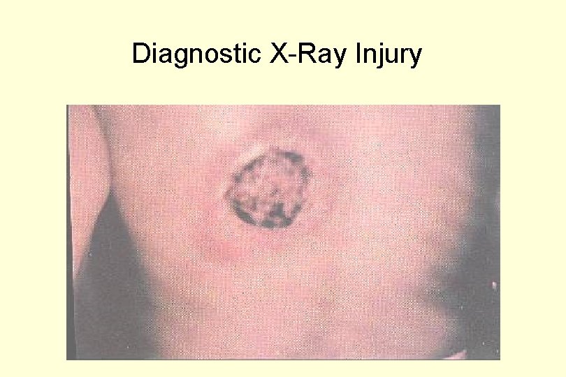 Diagnostic X-Ray Injury 
