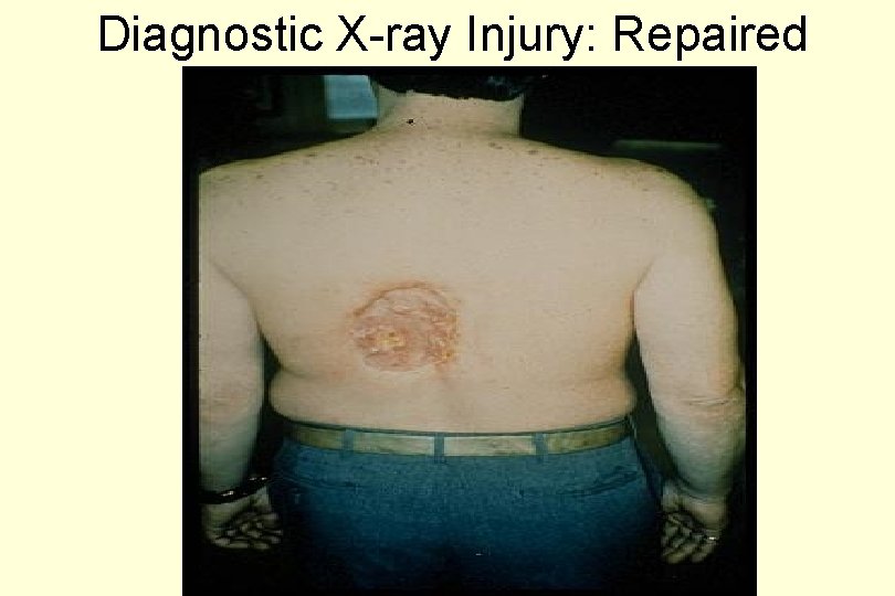Diagnostic X-ray Injury: Repaired 