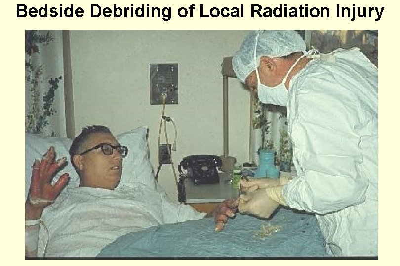Bedside Debriding of Local Radiation Injury 