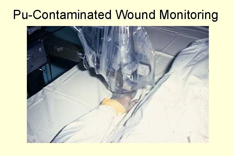 Pu-Contaminated Wound Monitoring 
