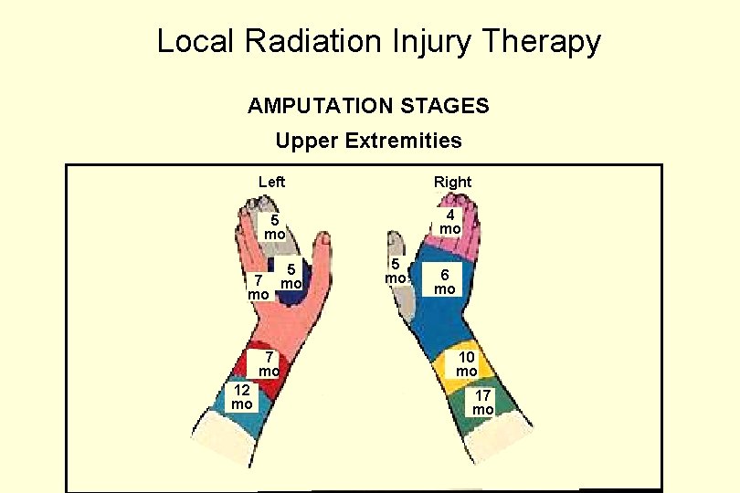 Basics of Treatment of Victims of Radiation Terrorism