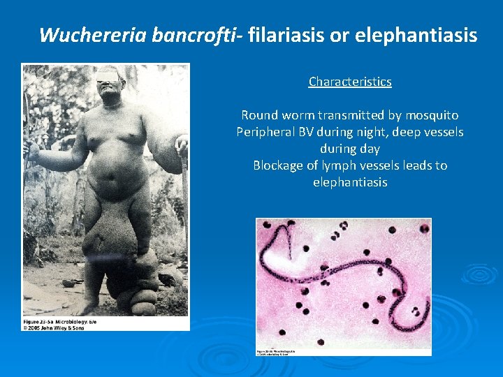 Wuchereria bancrofti- filariasis or elephantiasis Characteristics Round worm transmitted by mosquito Peripheral BV during
