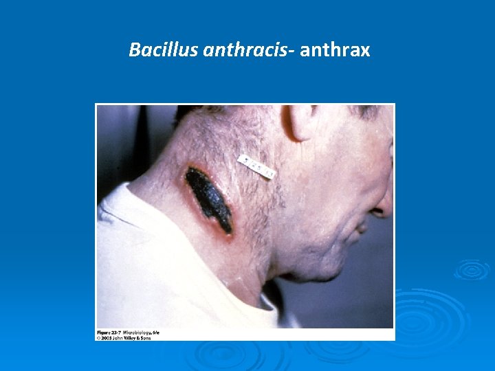 Bacillus anthracis- anthrax 
