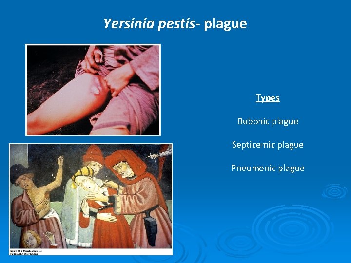 Yersinia pestis- plague Types Bubonic plague Septicemic plague Pneumonic plague 