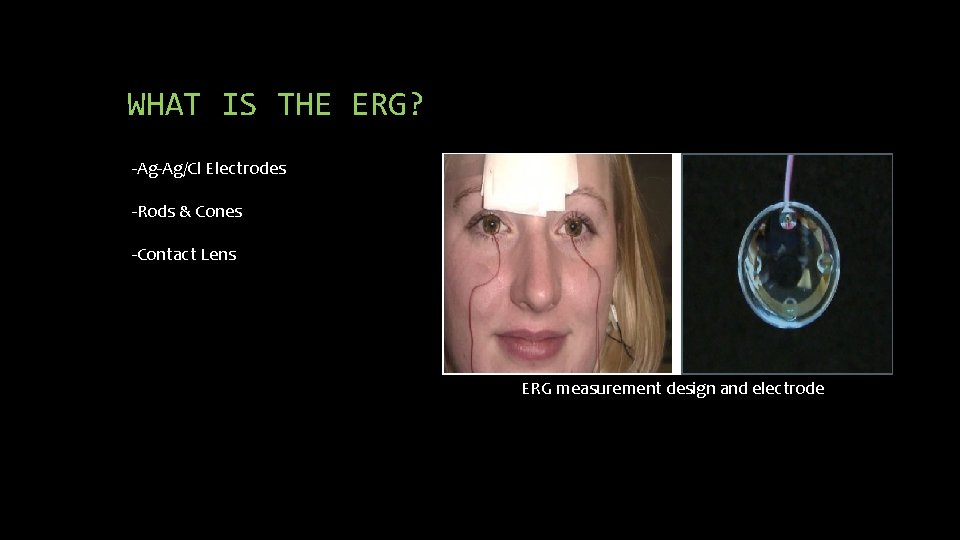 WHAT IS THE ERG? -Ag-Ag/Cl Electrodes -Rods & Cones -Contact Lens ERG measurement design