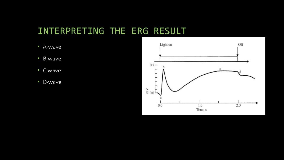 INTERPRETING THE ERG RESULT • A-wave • B-wave • C-wave • D-wave 