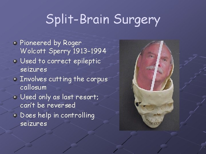 Split-Brain Surgery Pioneered by Roger Wolcott Sperry 1913– 1994 Used to correct epileptic seizures