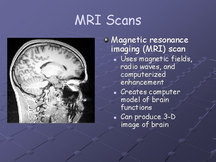 MRI Scans Magnetic resonance imaging (MRI) scan n Uses magnetic fields, radio waves, and