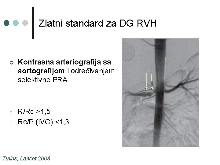 Zlatni standard za DG RVH ¢ Kontrasna arteriografija sa aortografijom i određivanjem selektivne PRA