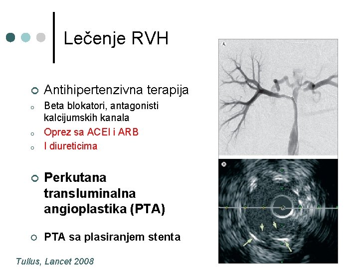 Lečenje RVH ¢ Antihipertenzivna terapija o Beta blokatori, antagonisti kalcijumskih kanala Oprez sa ACEI