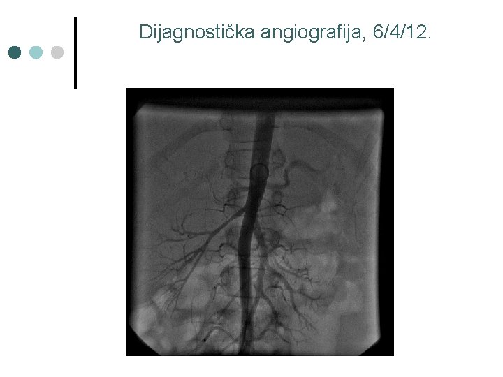 Dijagnostička angiografija, 6/4/12. 