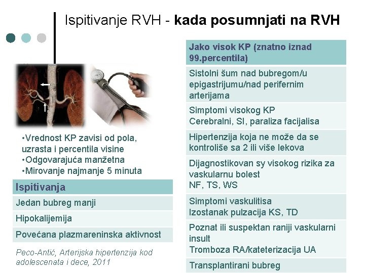 Ispitivanje RVH - kada posumnjati na RVH Jako visok KP (znatno iznad 99. percentila)