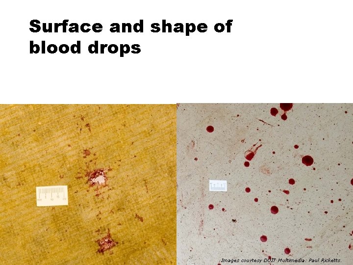 Surface and shape of blood drops Images courtesy DUIT Multimedia: Paul Ricketts. 