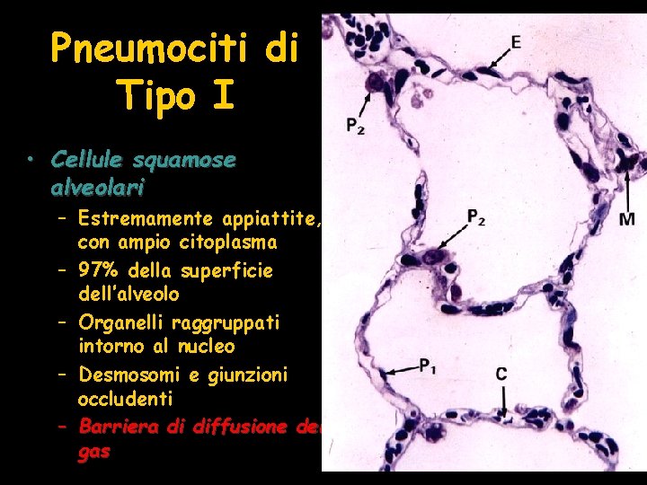 Pneumociti di Tipo I • Cellule squamose alveolari – Estremamente appiattite, con ampio citoplasma