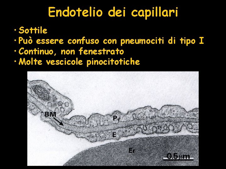 Endotelio dei capillari • Sottile • Può essere confuso con pneumociti di tipo I