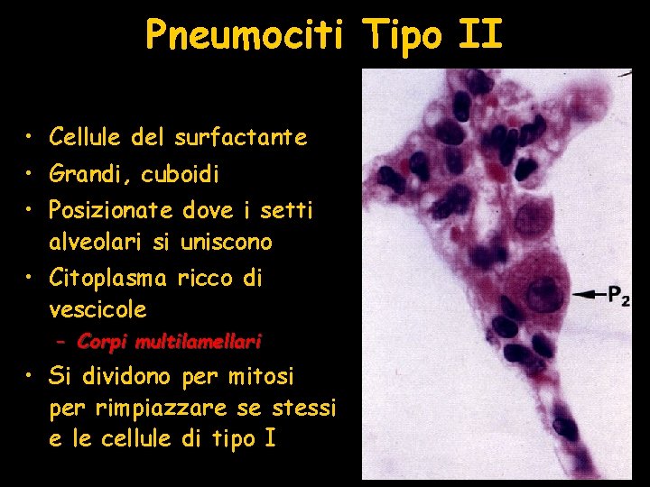 Pneumociti Tipo II • Cellule del surfactante • Grandi, cuboidi • Posizionate dove i