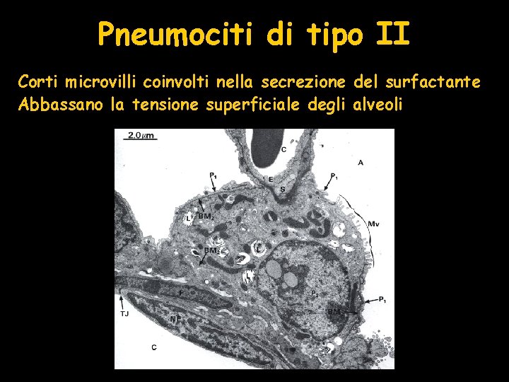 Pneumociti di tipo II Corti microvilli coinvolti nella secrezione del surfactante Abbassano la tensione