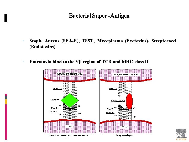Bacterial Super -Antigen Staph. Aureus (SEA-E), TSST, Mycoplasma (Exotoxins), Streptococci (Endotoxins) Entrotoxin bind to