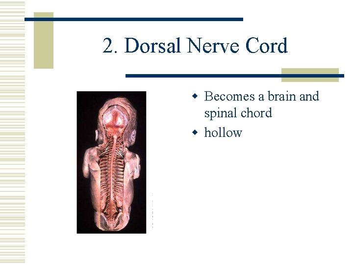 2. Dorsal Nerve Cord w Becomes a brain and spinal chord w hollow 