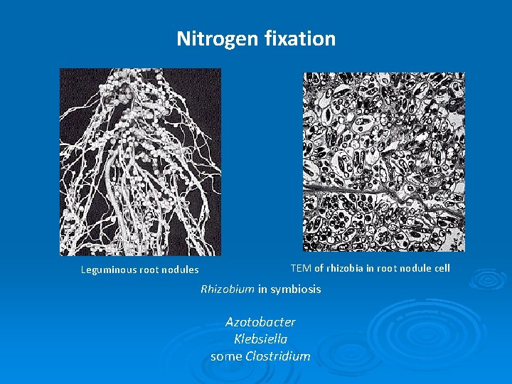 Nitrogen fixation Leguminous root nodules TEM of rhizobia in root nodule cell Rhizobium in