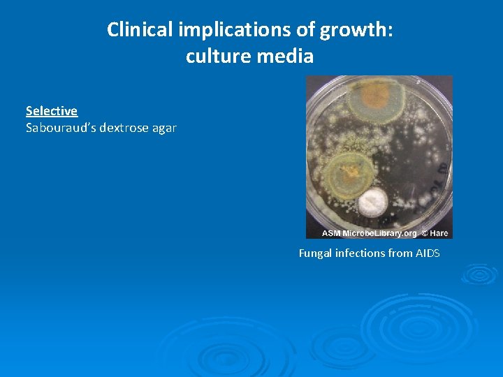 Clinical implications of growth: culture media Selective Sabouraud’s dextrose agar Fungal infections from AIDS